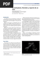 Caso Clinico Acondroplasia