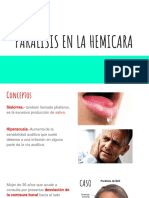 Paralisis en La Hemicara