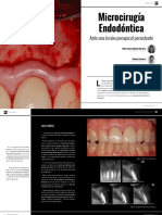 Microcirugia Endodóntica