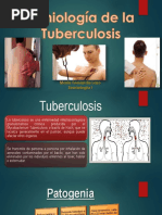 Semiología de La Tuberculosis