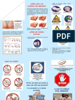 Ulcera Por Presion Esther