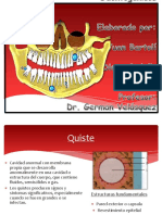 1 Quistes Odontogénicos