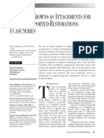 Telescopic Crowns As Attachments For Implant Supported Restorations A Case Series