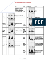 1partial Discharge Interpretation