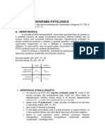 ECG 2 Patologie