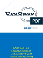  Cancer de Bexiga Localmente Avançado - Tratamento Adjuvante