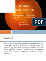 Neuritis Optik