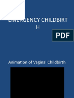 Emergency Childbirth