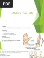 Colle's Fracture