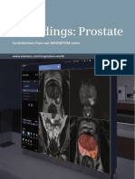 Siemens Mri Magnetom Mreadings Prostate PDF