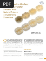 Porcelain-Fused-to-Metal and All-Ceramic Crowns For Posterior Teeth: Material Science and Laboratory Procedures