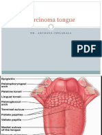 Carcinoma Tongue: DR - Archanachilakala