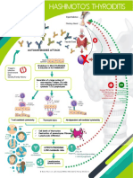 Hashimoto's Thyroiditis Infographic