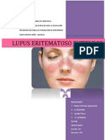 Lupus Eritematoso Sistemico