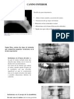 Cirugia Complicaciones