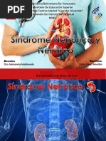 Sindrome Nefrotico y Nefritico Pediatria Mimu