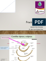 Fractura Costal Presentacion