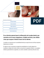 Pulpitis - Reversible e Irreversible - Causas, Síntomas, Diagnóstico y Tratamiento - Arriba Salud