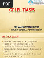 Tema 42 Colelitiasis DR Mateo