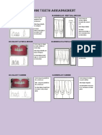 Anterior Teeth Arrangement 2