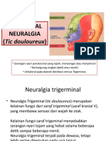 Trigeminal Neuralgia