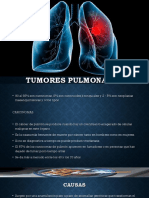 Tumores Pulmonares