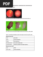 Informe Carne Daniela