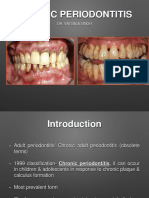 Chronic Periodontitis-Presented by DR Vatsala