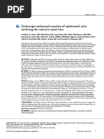 Epidermoid Cysts TNE