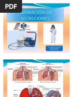 Aspiracion de Secreciones-ACanoM