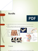 Bursitis