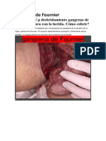 Gangrena de Fournier