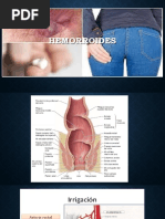 Hemorroides CIRUGIA