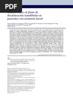 Análisis de Plano A Plano de Asimetria Mandibular. (1) .En - Es