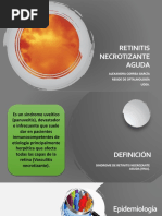 Retinitis Necrotizante Aguda