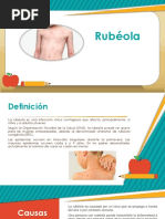 Rubéola