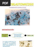 Cromoblastomicosis Seminario