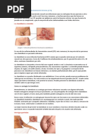 Enfermedades de Transmisión Sexual