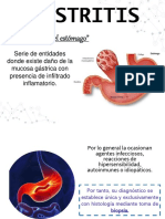 Gastritis Equipo 3