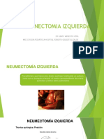 Neumonectomia Izquierda