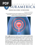 Cáncer de Cuello Uterino - Factores de Riesgo