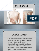 Colostomia