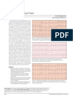 ECG Diagnosis: Type I Atrial Flutter: Clinical Medicine