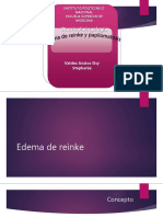 Edema de Reinke