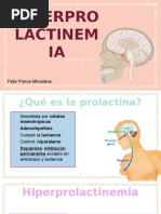 Hiperprolactinemia y Prolactinomas