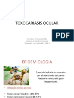 Toxocariasis Ocular