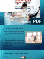 IMPLANTES