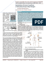 Implementation of Lower Leg Bone Fracture Detection From X Ray Images