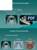 Generalidades de Protesis Parcial Removible