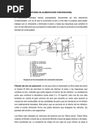 Sistema de Alimentación Convencional